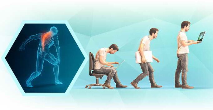 loše držanje pri radu za računalom i torakalnu osteohondrozu